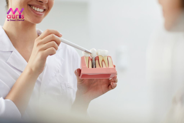 Tìm hiểu ưu nhược điểm trồng răng implant