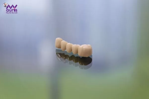 Vật liệu răng giả - Các yếu tố khác tác động đến chi phí trồng 1 răng bao nhiêu tiền